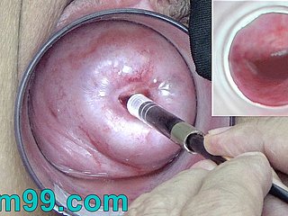Unfriendliness cámara endoscopio japonés dentro del cuello uterino en depress vagina Cam